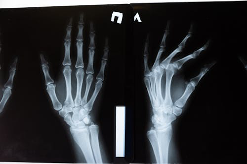 A person’s hand and its X-ray